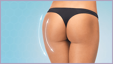 Glúteos Espectaculares con implantes