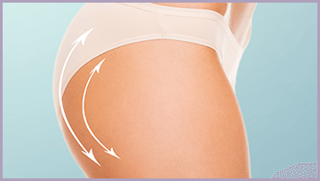 Que riesgos existen en una cirugia de implantes de gluteos